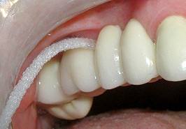 ORAL-B SUPERFLOSS DENTAL flosser superfloss 50 SEKCIÍ Flosser