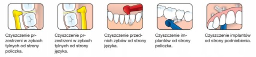 Uhlové medzizubné kefky 0,4mm Ružová 6ks