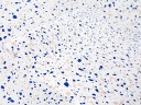 Samolepiaca Terrazzo Veneer Porcelain Blue DIY