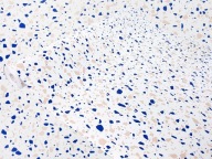 Samolepiaca Terrazzo Veneer Porcelain Blue DIY