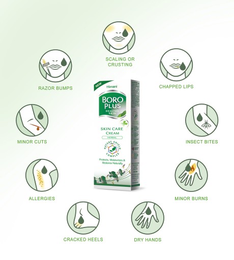AJUVERDSKÝ KRÉM BORO PLUS BYLINKOVÝ 25ml EZEMA