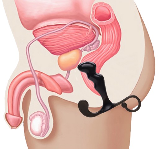 Masážny prístroj na prostatu a perineum, pevná zátka s rukoväťou