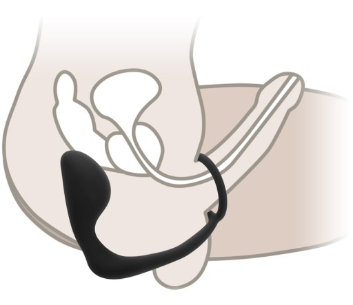 MASÁŽER PROSTATY ANÁLNY PRUG PENIS PRSTEŇ