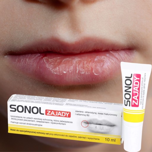 Sonol Zajady masť 10 ml