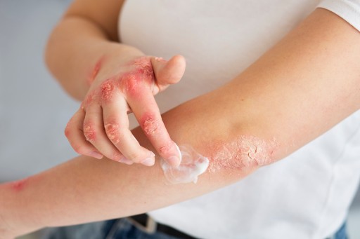Ziaja Med AZS ošetrujúca, upokojujúca a olejujúca emulzia na ruky 100ml