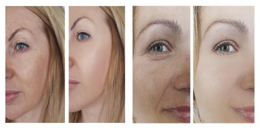 KRÉM NA TVÁR S RETINOLOM A VITAC PERFECTA BAKUCHIOL 30+