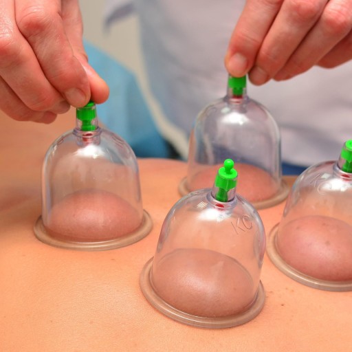 ČÍNSKE VAKUUM CUPBLING BEZPOŽIARNÁ CELULITÍDA 12 ks