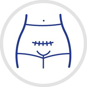 POZRODNÉ NOHAVIČKY CANPOL OPÄTOVNE POUŽITEĽNÉ L/XL 2 KS.