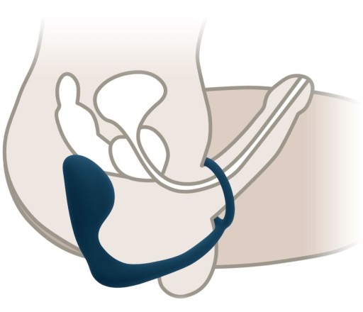MASÁŽER PROSTATY ANÁLNY PRUG PENIS PRSTEŇ