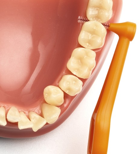 TePe UHLOVÉ MEDZIZUBNÉ KEFKY 0,45mm VEĽKOSŤ 1 ORANŽOVÁ 6ks