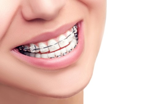 Gum Ortho ortodontická zubná kefka 1 ks