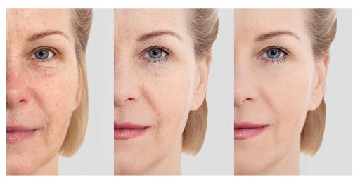 SPEVŇUJÚCI KRÉM NA TVÁR S KYSELINOU HYALURONOVOU A RETINOLOM PERFECTA 50+
