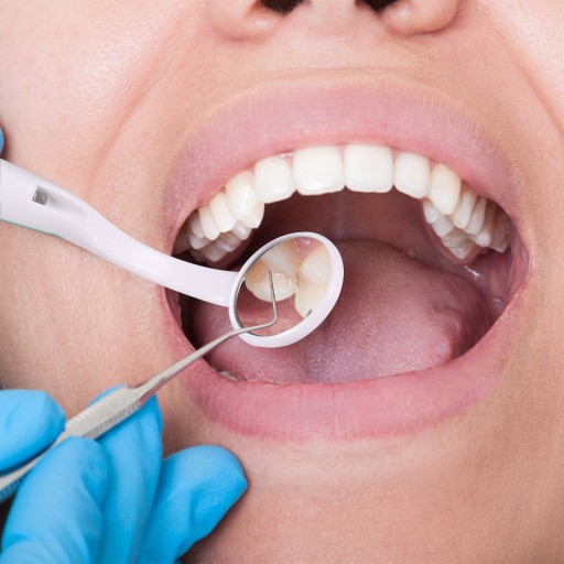 DENTÁLNE DENTÁLNE ZRKADLO SA Zväčšuje