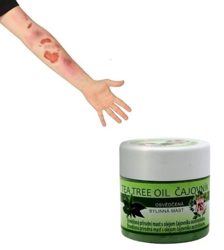 Masť s čajovníkovým olejom 150 ml