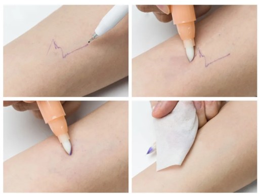 Prima Derma korektor na chirurgické odstránenie markerov
