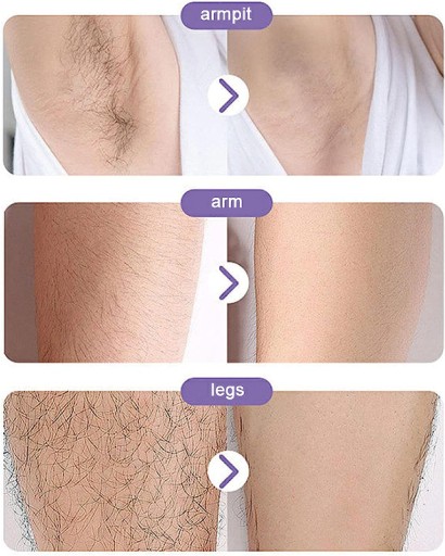 BEZBOLESTIVÝ DEPILÁTOR, EXFOLIAČNÉ ODSTRAŇOVANIE VLASOV