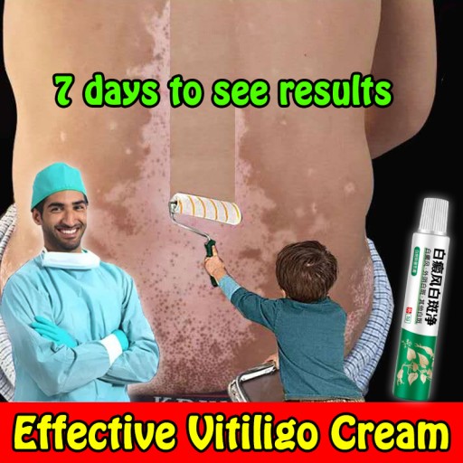 Vitiligo krém Suai Vitiligo 20g