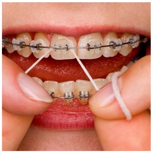 ORAL-B Essential Floss BEZVOSKOVANÁ ZUBNÁ NITE mätová 50m