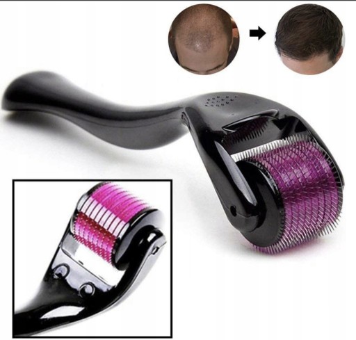 DERMA ROLLER, HUSTÁ BRADA, MEZOTERAPIA, VLASY