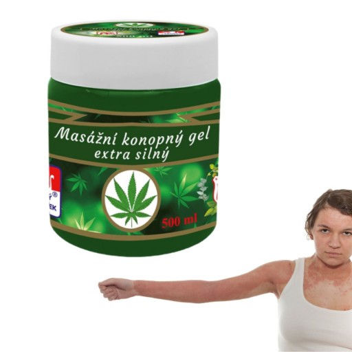 Protizápalová konopná masť na popáleniny od psoriázy