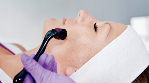 DERMA ROLLER, HUSTÁ BRADA, MEZOTERAPIA, VLASY