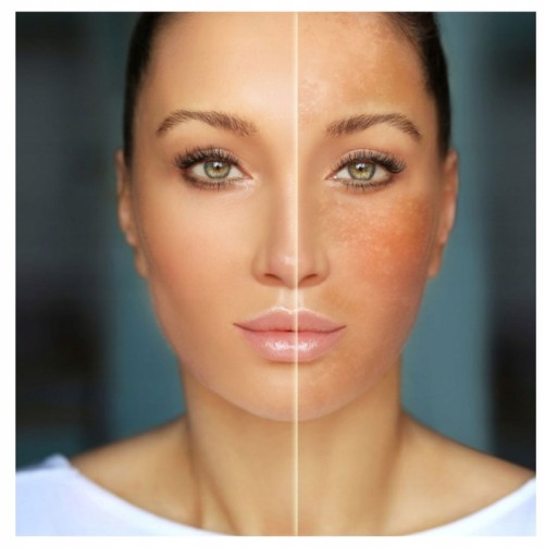 TVÁROVÉ TONIKUM NA ODFARENIE S VITAMÍNOM C REVITALIZUJÚCE DERMÉNU