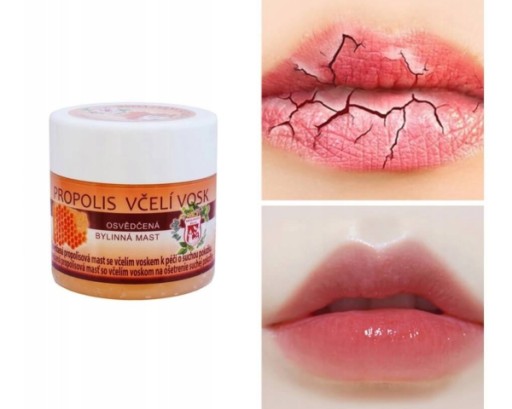 Propolisová masť s včelím voskom 150 ml