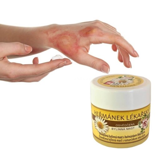 Protizápalová masť na popáleniny a akné 150 ml