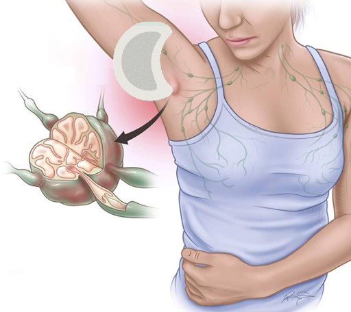 DETOXIKAČNÉ NÁPLAHY ČISTIACE TOXÍNY BYLINKOVÝ LYMFATICKÝ DETOX