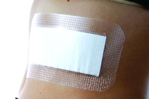 OPSITE POST-OP Vodeodolný obväz 6,5 x 5cm 1 ks