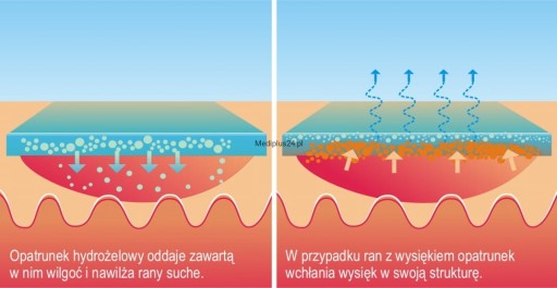 Kikgel Aqua Gel Aquagel Aqua-Gel gélový obväz na otlaky a popáleniny