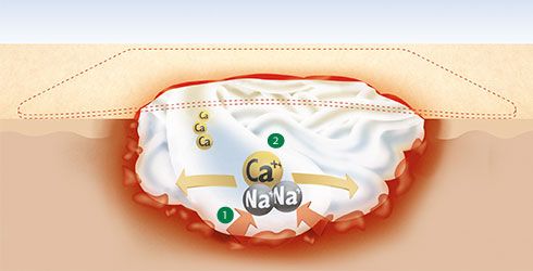 Suprasorb A alginátový obväz 5x5cm 1 ks použiť aj ako tamponáda
