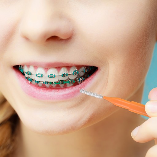 100 ortodontických zubných kefiek - praktická a ľahká hygienická sada