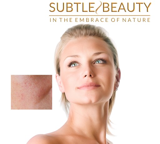 Gaštanový olej Subtle Beauty - Kapiláry - 50 ml.