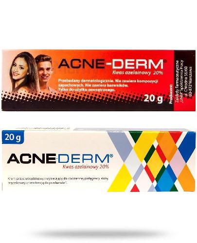 Akné-Derm krém s kyselinou azelaovou 20% 20 g