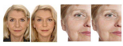 ELIXÍROVÝ KRÉM MLÁDEŽE PROTI VRÁSKAM S PEPTIDMI PERFECTA 60+
