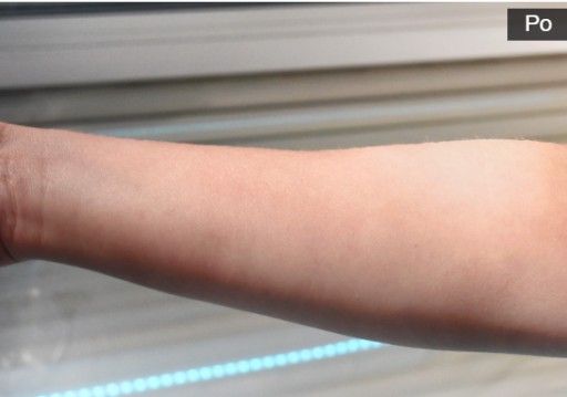 Hydratačný urýchľovač opálenia 7suns