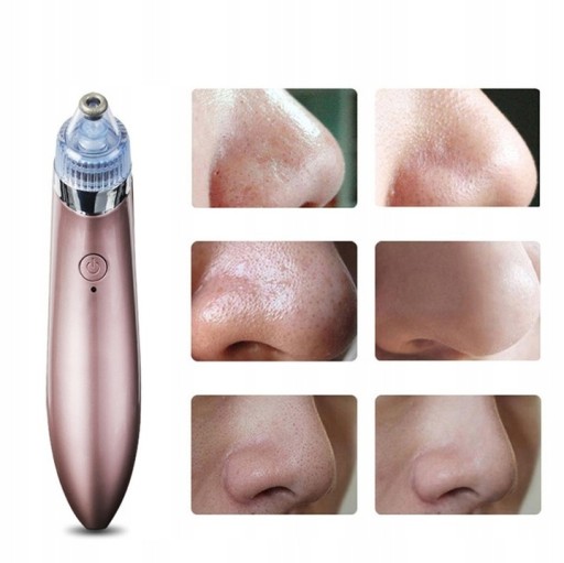 VYSÁVAČ BLACKHEADS DIAMANTOVÁ MIKRODERMABRÁZIA 12V1