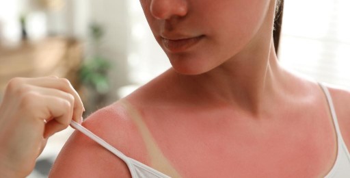 ukľudňujúci a ukľudňujúci gél po opaľovaní, aloe ALOE VERA OHUOE 50g