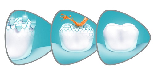 Sensodyne ProEnamel Jemná bieliaca zubná pasta 75 ml