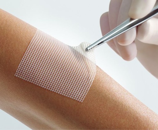 Lohmann & Rauscher Lomatuell Pro obväz s hydrokoloidnými časticami 1 ks