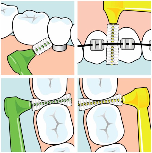 Tepe Angle medzizubné kefky 0,4mm ISO 0 6 ks