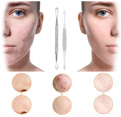 7x LYŽIČKA NA ODSTRAŇOVANIE BLACKhead SET LYŽIČKA
