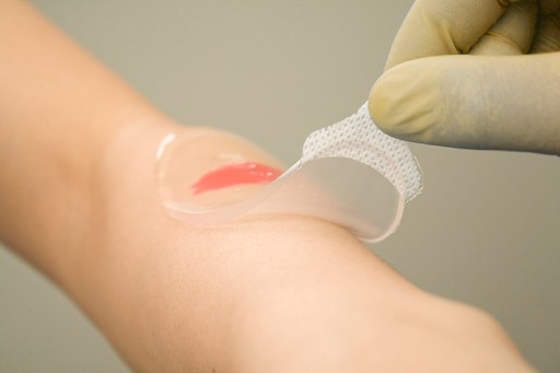 Kikgel Aqua Gel Aquagel Aqua-Gel gélový obväz na otlaky a popáleniny