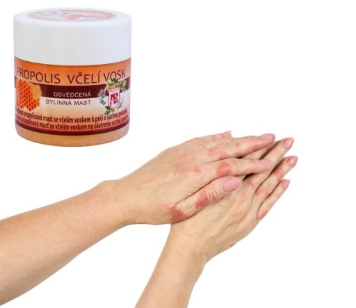 Propolisová masť PROPOLIS Včelí vosk 150ml