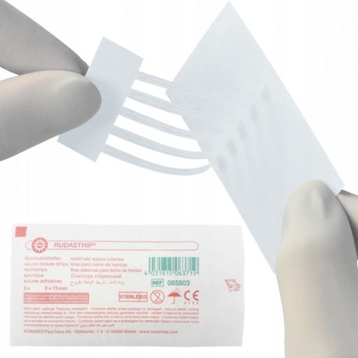 NOBAMED Rudastrip pásik na zapínanie 3 mm x 75 mm 5 ks.