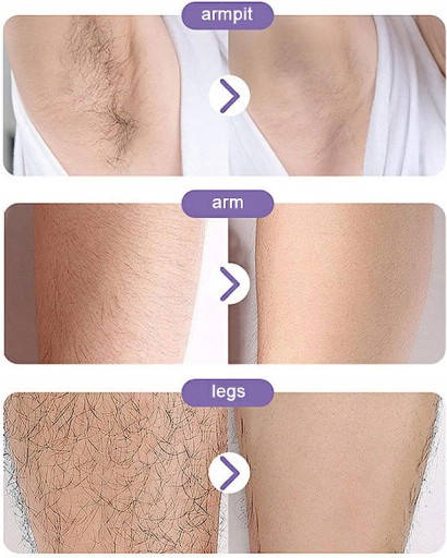 BEZBOLESTIVÝ DEPILÁTOR, EXFOLIAČNÉ ODSTRAŇOVANIE VLASOV