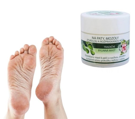 Masť na kurie oká, mozole, suché popraskané päty 150ml