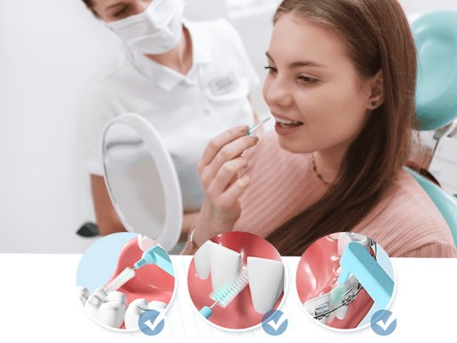 MEDZIZUBNÉ ČISTIČE MEDZIZUBNÉ KEFKY 0,7mm x5