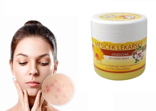 Nechtíková masť s nechtíkom nechtíkovým 150 ml